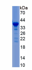 Recombinant Induced Myeloid Leukemia Cell Differentiation Protein Mcl-1 (MCL1)