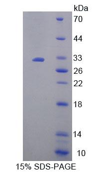 Recombinant Mitofusin 1 (MFN1)