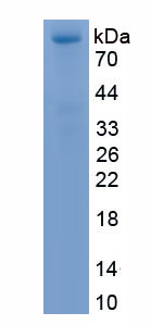 Recombinant Midline 1 (MID1)