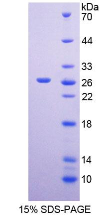 Recombinant Methionine Sulfoxide Reductase A (MSRA)