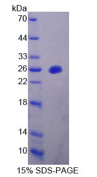 Recombinant Mitochondrial Tumor Suppressor 1 (MTUS1)