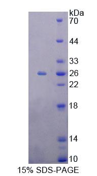 Recombinant Metaxin 1 (MTX1)