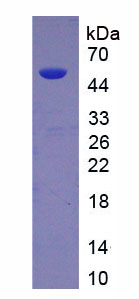 Recombinant Megakaryocyte Associated Tyrosine Kinase (MATK)