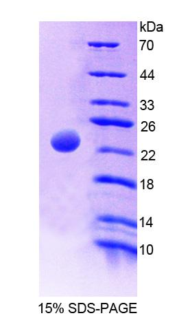 Recombinant Megakaryocyte Associated Tyrosine Kinase (MATK)