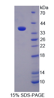 Recombinant Monoamine Oxidase B (MAOB)