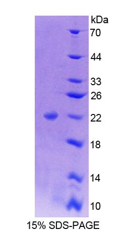 Recombinant Nuclear Factor I/A (NFIA)