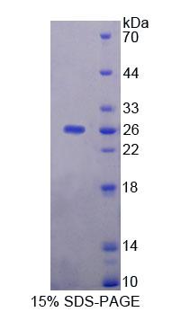 Recombinant Ninein (NIN)