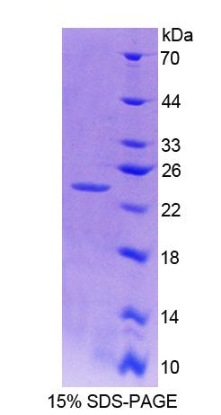 Recombinant Ninein (NIN)