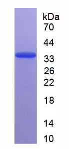 Recombinant Insulin Like Growth Factor Binding Protein 5 (IGFBP5)