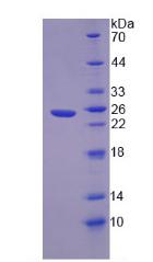 Recombinant Neuro Oncological Ventral Antigen 1 (NOVA1)