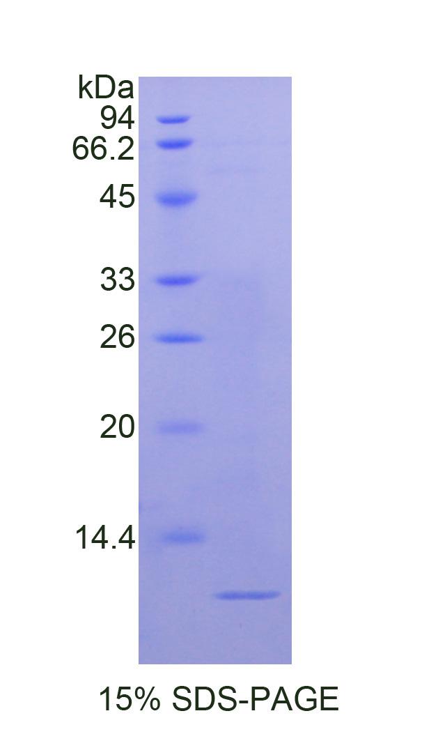 Recombinant Nucleophosmin 1 (NPM1)