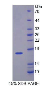 Recombinant Neuron Derived Orphan Receptor 1 (NOR1)