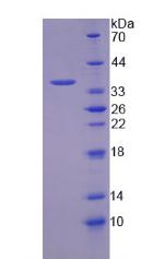 Recombinant Purine Nucleoside Phosphorylase (PNP)