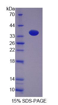 Recombinant Purine Nucleoside Phosphorylase (PNP)