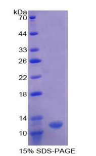 Recombinant 2',5'-Oligoadenylate Synthetase 1 (OAS1)