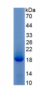 Recombinant Anoctamin 2 (ANO2)