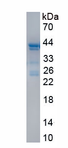 Recombinant Oxytocin Receptor (OXTR)