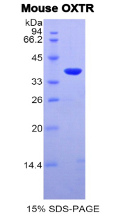 Recombinant Oxytocin Receptor (OXTR)