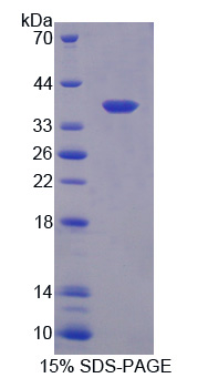 Recombinant Oxytocin Receptor (OXTR)