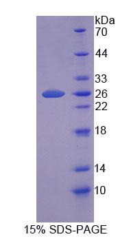 Recombinant Pantothenate Kinase 1 (PANK1)