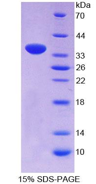 Recombinant Pericentrin (PCNT)