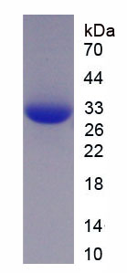 Recombinant Pericentrin (PCNT)