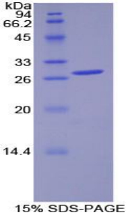 Recombinant Pyruvate Dehydrogenase Kinase Isozyme 1 (PDK1)