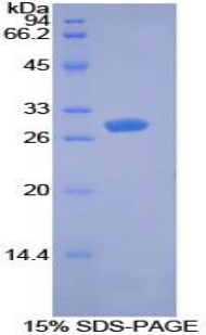 Recombinant Pyruvate Dehydrogenase Kinase Isozyme 1 (PDK1)