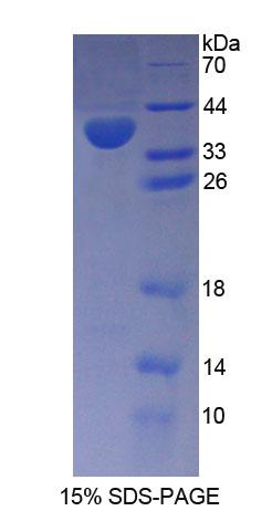 Recombinant Phosphomannomutase 1 (PMM1)