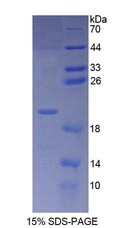 Recombinant Proteasome Maturation Protein (POMP)