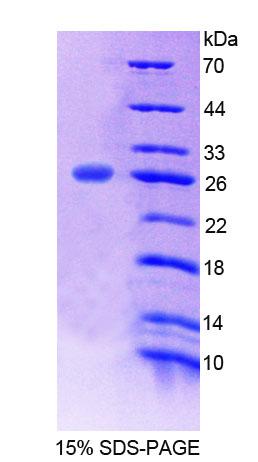 Recombinant Protein O-Mannosyltransferase 1 (POMT1)