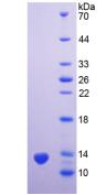 Recombinant Prostate Stem Cell Antigen (PSCA)