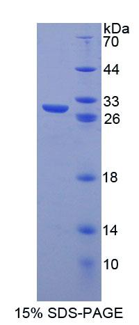 Recombinant Pituitary Tumor Transforming 1 (PTTG1)