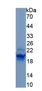 Recombinant Perilipin 1 (PLIN1)