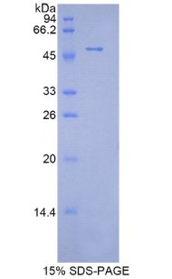 Recombinant Peroxiredoxin 1 (PRDX1)