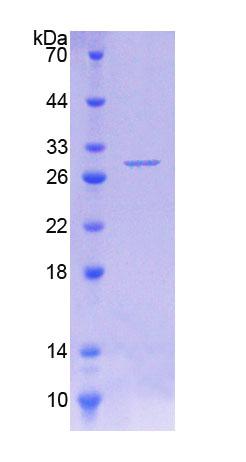 Recombinant Phenylalanine Hydroxylase (PAH)