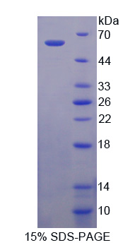 Recombinant Prosaposin (PSAP)