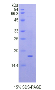 Recombinant Quiescin Q6 Sulfhydryl Oxidase 1 (QSOX1)