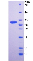 Recombinant Regucalcin (RGN)