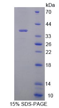 Recombinant Regucalcin (RGN)