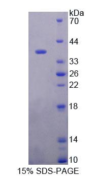 Recombinant Regucalcin (RGN)