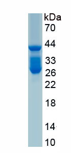 Recombinant Rhodopsin (RHO)