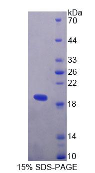 Recombinant T-Cell Lymphoma Invasion And Metastasis Inducing Protein 1 (TIAM1)