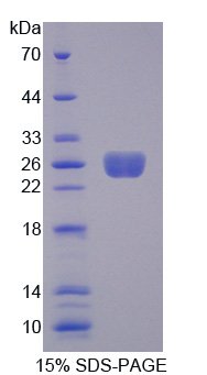 Recombinant Transgelin (TAGLN)