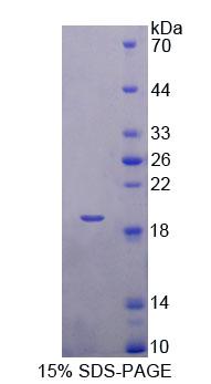 Recombinant Tubulin Folding Cofactor A (TBCA)