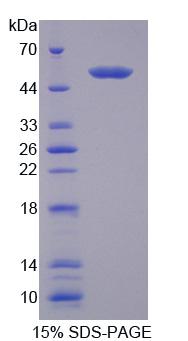 Recombinant Tyrosyl DNA Phosphodiesterase 1 (TDP1)