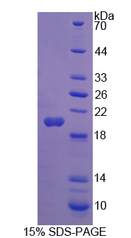 Recombinant Thyroid Hormone Responsive (THRSP)