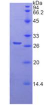 Recombinant Transmembrane Protease, Serine 2 (TMPRSS2)