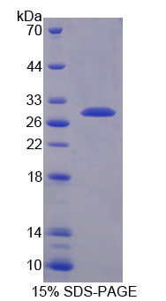 Recombinant Transmembrane Protease, Serine 2 (TMPRSS2)