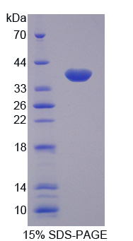 Recombinant Tumor Necrosis Factor Alpha Induced Protein 3 (TNFaIP3)